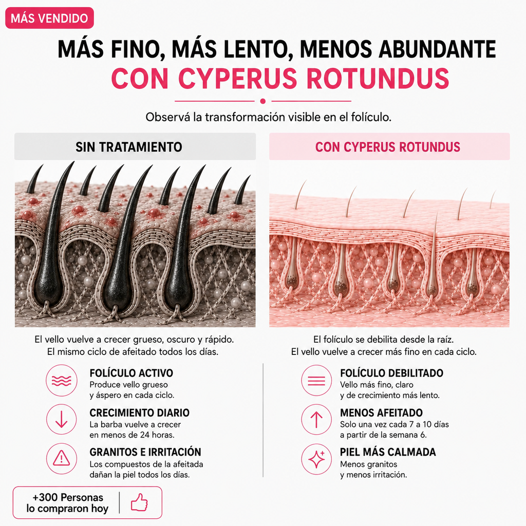 LeSabag — Hair Reduction. Menos vello. Más vos