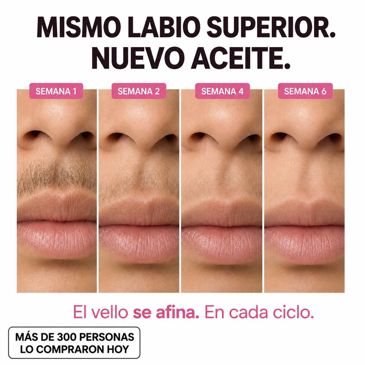 LeSabag — Hair Reduction. Menos vello. Más vos